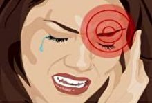 علائم میگرن چشمی چیست؟