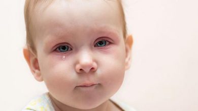 علت عفونت چشم در کودکان + روش های درمانی