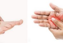 علت بی حسی دست و پا؛ ۱۲ دلیل و روشهای درمانی